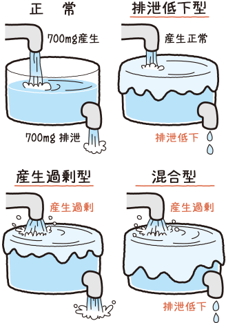 尿酸の増える原因で３タイプに分かれる高尿酸血症