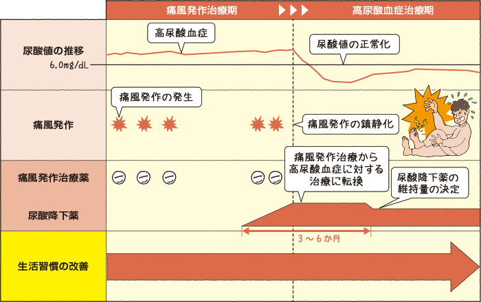 痛風の治療・予防のコツ｜激痛！痛風を予防する｜高尿酸血症・痛風｜三和化学研究所