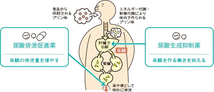 尿酸値を下げる薬には２種類あります