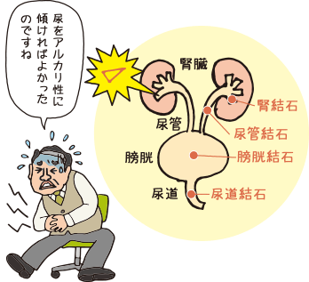 コラム 中韓エスニック編 クイズ プリン体の少ない食事はどっち 高尿酸血症 痛風 三和化学研究所